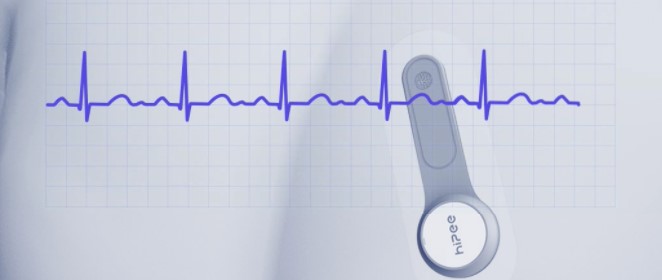 HiPee Dinamika EKG-Registrilo